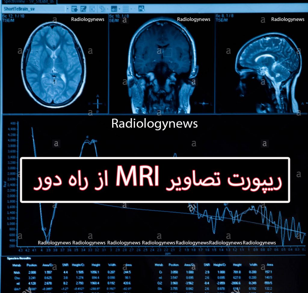ریپورت تصاویر MRI از راه دور